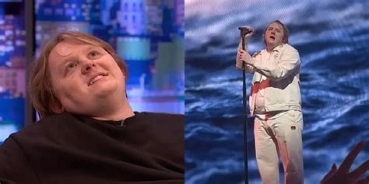 Lewis Capaldi Revealed That He is Diagnosed With Tourette’s Syndrome